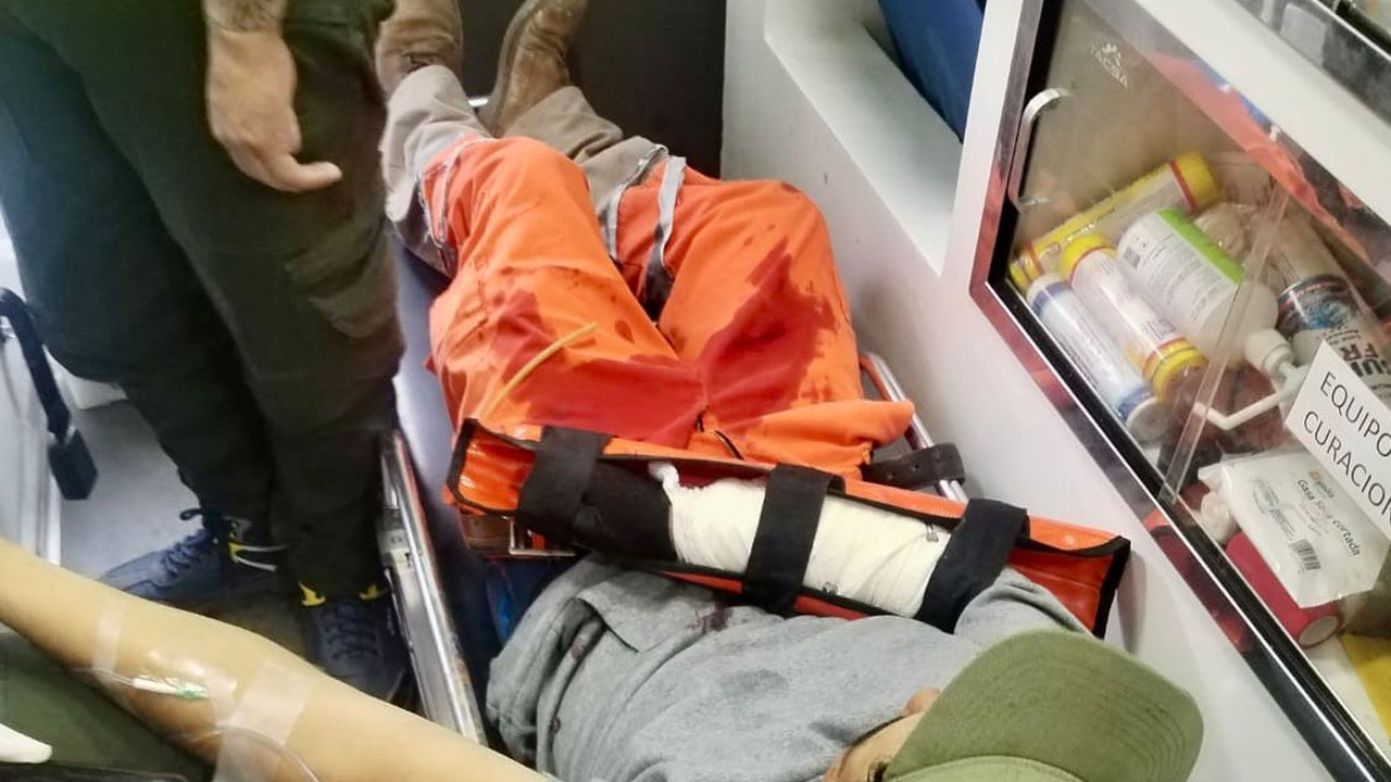 Protección civil de la capital atiende a trabajador municipal lesionado en maniobras de compactador